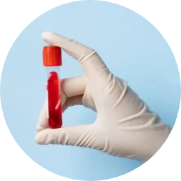Blood Test