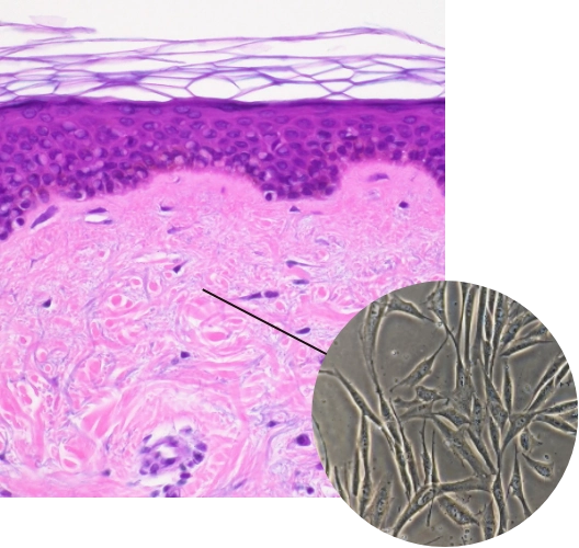 What's dermal fibroblasts?