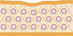 Aging skin